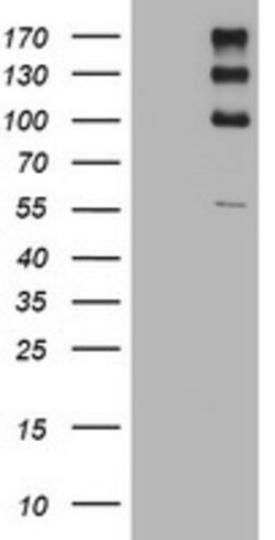 ALK Mouse anti-Human, Clone: OTI11H4, lyophilized, TrueMAB 100 &mu;g; Unconjugated:Antibodies,