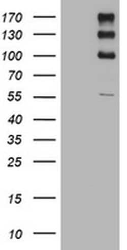 ALK Monoclonal Antibody (OTI11H4), TrueMAB , OriGene:Antibodies:Primary