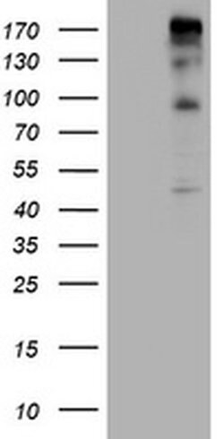 ALK Monoclonal Antibody (OTI22F2), TrueMAB , OriGene 100 &mu;L; Unconjugated:Antibodies,