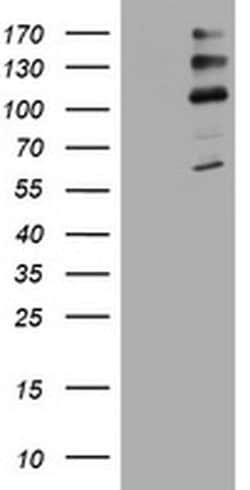 ALK Monoclonal Antibody (OTI2D5), TrueMAB , OriGene:Antibodies:Primary