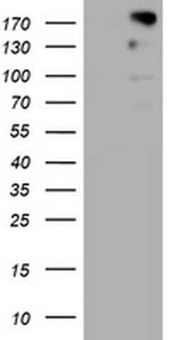 ALK Monoclonal Antibody (OTI40F10), TrueMAB , OriGene:Antibodies:Primary