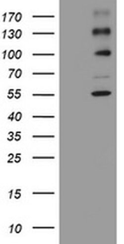 ALK Monoclonal Antibody (OTI14E4), TrueMAB , OriGene 30 &mu;L; Unconjugated:Antibodies,