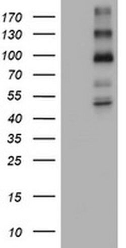 ALK Monoclonal Antibody (OTI4D1), TrueMAB , OriGene 30 &mu;L | Buy Online | Origene Technologies | Fisher Scientific