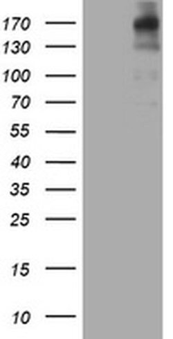 ALK Monoclonal Antibody (OTI5G1), TrueMAB , OriGene:Antibodies:Primary