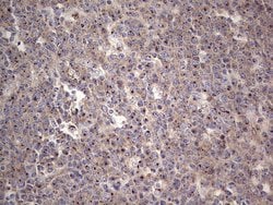 ALKBH1 Monoclonal Antibody (OTI4C4), TrueMAB , OriGene:Antibodies:Primary