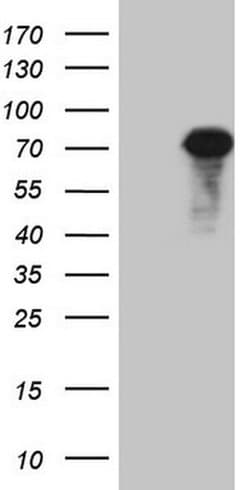 ALOX12 Monoclonal Antibody (OTI5H2), TrueMAB , OriGene:Anticuerpos:Anticuerpos