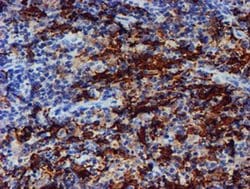 ALOX15 Monoclonal Antibody (OTI2G3), TrueMAB , OriGene 100 &mu;L; Unconjugated:Anticuerpos