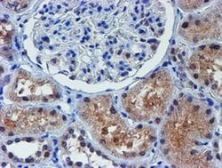 ALOX15 Monoclonal Antibody (OTI2G3), TrueMAB , OriGene 100 &mu;L; Unconjugated:Anticuerpos