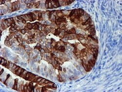 ALOX15 Monoclonal Antibody (OTI8C5), TrueMAB , OriGene 100 &mu;L; Unconjugated:Antibodies,