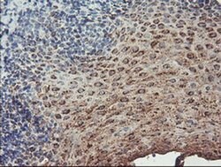 ALOX15 Monoclonal Antibody (OTI8C5), TrueMAB , OriGene 100 &mu;L; Unconjugated:Antibodies,