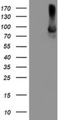 ALOX15 Monoclonal Antibody (OTI2G3), TrueMAB , OriGene 100 &mu;L; Unconjugated:Anticuerpos