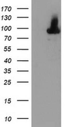ALOX15 Monoclonal Antibody (OTI8C5), TrueMAB , OriGene 100 &mu;L; Unconjugated:Antibodies,
