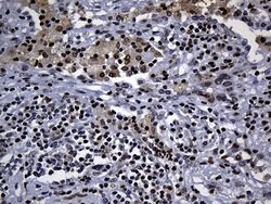 ALOX5 Monoclonal Antibody (OTI1A1), TrueMAB , OriGene 100 &mu;L; Unconjugated:Antibodies,