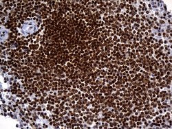 ALOX5 Monoclonal Antibody (OTI1A1), TrueMAB , OriGene 100 &mu;L; Unconjugated:Antibodies,