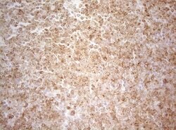 ALOX5 Mouse anti-Human, Clone: OTI2C5, lyophilized, TrueMAB 100 &mu;g;