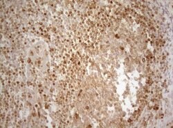 ALOX5 Mouse anti-Human, Clone: OTI2C5, lyophilized, TrueMAB 100 &mu;g;