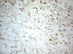 ALOX5 Mouse anti-Human, Clone: OTI2C5, lyophilized, TrueMAB 100 &mu;g;