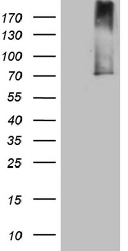 ALOX5 Monoclonal Antibody (OTI1D6), TrueMAB , OriGene:Antibodies:Primary