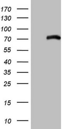 ALOX5 Monoclonal Antibody (OTI2C7), TrueMAB , OriGene 100 &mu;L; Unconjugated:Antibodies,