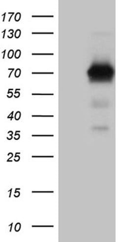 ALPI Mouse anti-Human, Clone: OTI3C1, lyophilized, TrueMAB 100 &mu;g; Unconjugated:Antibodies,
