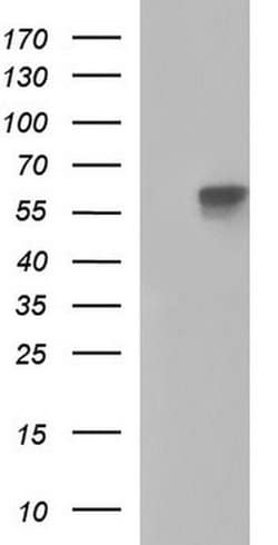 ALPP Monoclonal Antibody (OTI1H2), TrueMAB , OriGene 100 &mu;L; Unconjugated:Antibodies,