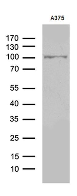 ALS2CR11 Mouse anti-Human, Clone: OTI7A8, lyophilized, TrueMAB 100 &mu;g;