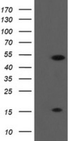 ALX4 Mouse anti-Human, Clone: OTI2F2, lyophilized, TrueMAB 100 &mu;g | Buy Online | Origene Technologies | Fisher Scientific