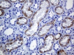 AMACR Monoclonal Antibody (OTI2A11), TrueMAB , OriGene 100 &mu;L; Unconjugated:Antibodies,