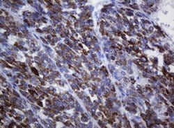 AMACR Monoclonal Antibody (OTI2A11), TrueMAB , OriGene 100 &mu;L; Unconjugated:Antibodies,