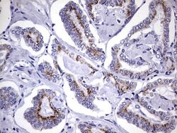 AMACR Monoclonal Antibody (OTI5G8), TrueMAB , OriGene 100 &mu;L; Unconjugated:Antibodies,