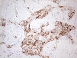 AMACR Monoclonal Antibody (OTI3E10), TrueMAB , OriGene:Antibodies:Primary