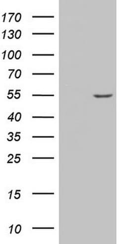 AMACR Monoclonal Antibody (OTI5G8), TrueMAB , OriGene 100 &mu;L; Unconjugated:Antibodies,