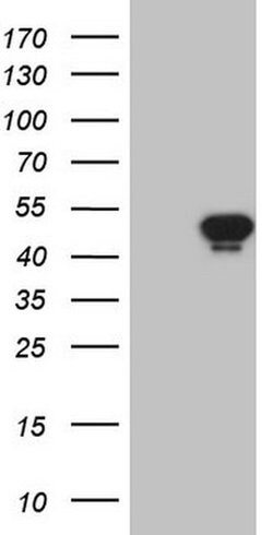 AMACR Monoclonal Antibody (OTI3H10), TrueMAB , OriGene 30 &mu;L; Unconjugated:Antibodies,