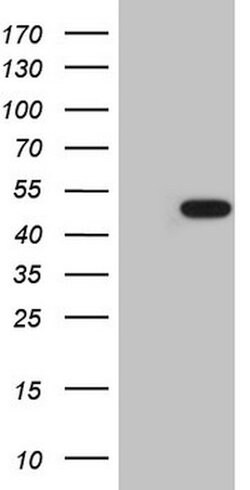 AMACR Mouse anti-Human, Clone: OTI6C7, lyophilized, TrueMAB 100 &mu;g;
