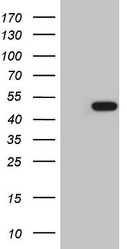 AMACR Monoclonal Antibody (OTI6C7), TrueMAB , OriGene 100 &mu;L; Unconjugated:Antibodies,