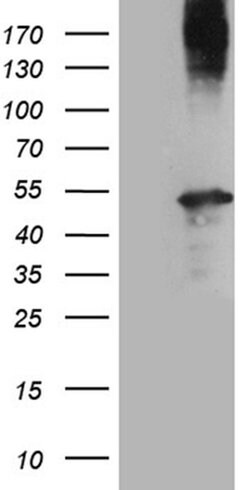 AMDHD1 Monoclonal Antibody (OTI2D3), TrueMAB , OriGene 100 &mu;L; Unconjugated:Antibodies,