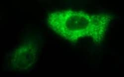AMOT Monoclonal Antibody (OTI1A8), TrueMAB , OriGene:Antibodies:Primary