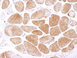 AMPK alpha 1 Polyclonal Antibody, Bethyl Laboratories:Antibodies:Primary