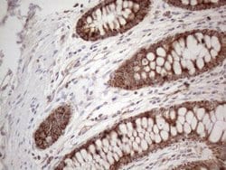 AMT Monoclonal Antibody (OTI6F4), TrueMAB , OriGene 100 &mu;L; Unconjugated:Antibodies,
