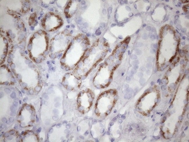 AMTN Mouse anti-Human, Clone: OTI5E2, lyophilized, TrueMAB 100 μg ...