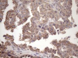 AMTN Mouse anti-Human, Clone: OTI2D9, lyophilized, TrueMAB 100 &mu;g; Unconjugated:Antibodies,