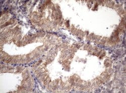 AMTN Monoclonal Antibody (OTI2D9), TrueMAB , OriGene 100 &mu;L; Unconjugated:Antibodies,
