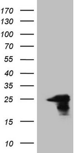 AMTN Mouse anti-Human, Clone: OTI2G5, lyophilized, TrueMAB 100 &mu;g; Unconjugated:Antibodies,