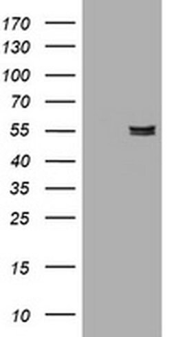 AMY2B Monoclonal Antibody (OTI4B5), TrueMAB , OriGene 100 &mu;L; Unconjugated:Antibodies,