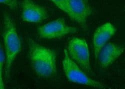 ANAPC11 Monoclonal Antibody (OTI1B5), TrueMAB , OriGene 100 &mu;L; Unconjugated:Antibodies,