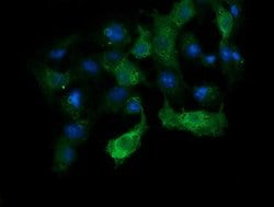 ANAPC11 Mouse anti-Human, Clone: OTI1B11, lyophilized, TrueMAB 100 &mu;g;