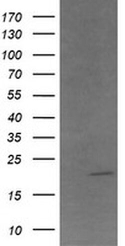 ANAPC11 Monoclonal Antibody (OTI3C4), TrueMAB , OriGene 100 &mu;L; Unconjugated:Anticuerpos