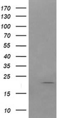 ANAPC11 Monoclonal Antibody (OTI1B11), TrueMAB , OriGene 100 &mu;L | Buy Online | OriGene | Fisher Scientific