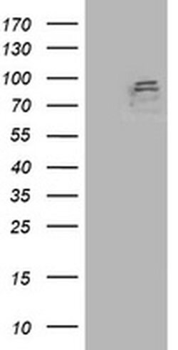 ANAPC2 Monoclonal Antibody (OTI2A1), TrueMAB , OriGene 30 &mu;L; Unconjugated:Antibodies,