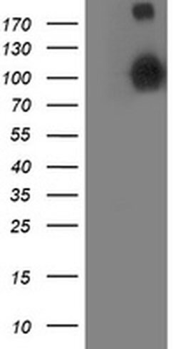 ANAPC2 Monoclonal Antibody (OTI1A6), TrueMAB , OriGene 100 &mu;L; Unconjugated:Antibodies,